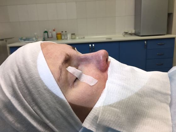 Певица и журналистка Катя Гордон сделала пластическую операцию Певица и журналистка Катя Гордон сделала пластическую операцию