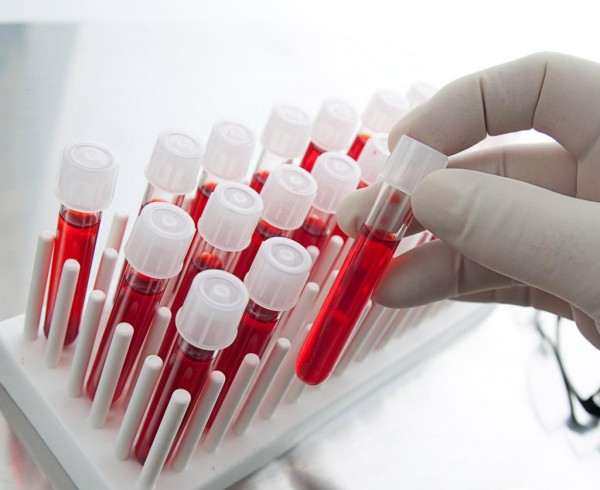 Ученые научились определять дату смерти по анализу крови