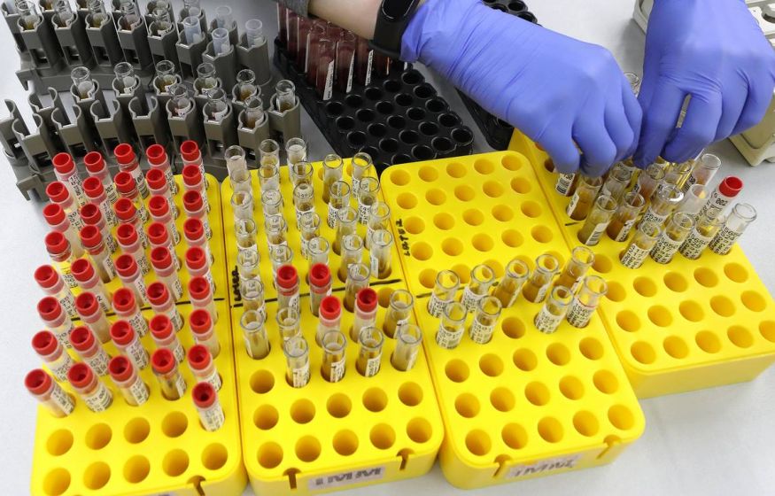 Революция в медицине: в России придумали первый в мире быстрый тест на гепатит С — диагноз за 25 минут! Революция в медицине: в России придумали первый в мире быстрый тест на гепатит С — диагноз за 25 минут!