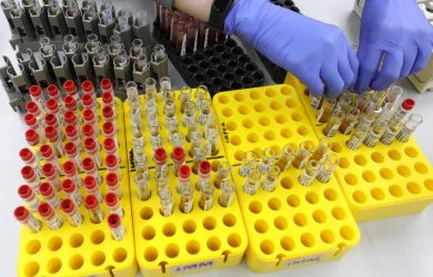 Революция в медицине: в России придумали первый в мире быстрый тест на гепатит С — диагноз за 25 минут!