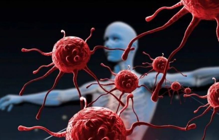 Первые вакцины от рака: старт лечения онкологии в Москве Первые вакцины от рака: старт лечения онкологии в Москве