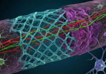 Прорыв в медицине. У людей страдающих параличом появилась надежда начать двигаться